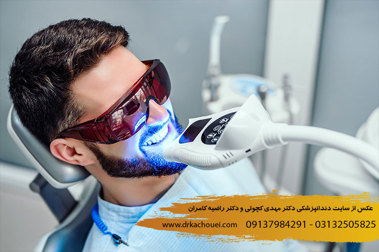 آفیس بلیچینگ یا سفید کردن دندان (در مطب دندانپزشکی) | دندانپزشکی مهدی کچوئی و راضیه کامران