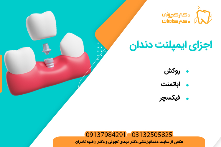 ایمپلنت دندان چیست؟ اجزای ایمپلنت دندان
دکتر مهدی کچوئی و دکتر راضیه کامران