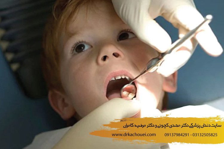 عصب کشی دندان شیری و دائمی در کودکان