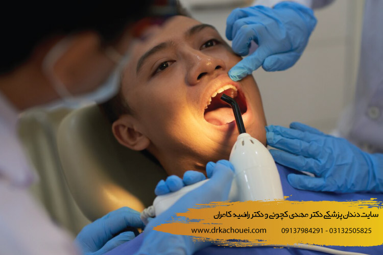 توصیه های بعد از پر کردن دندان | بهترین کلینیک دندانپزشکی ترمیم زیبایی دندان در اصفهان (دکتر کچویی و دکتر کامران)