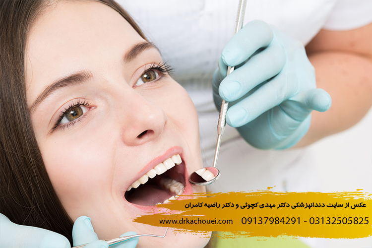  اقدامات قبل از آفیس بلیچینگ| دندانپزشکی دکتر مهدی کچوئی و دکتر راضیه کامران