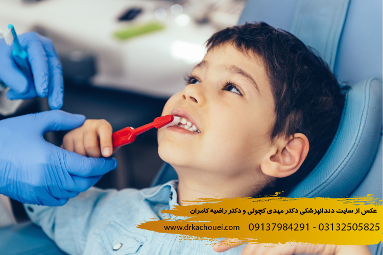 بلیچینگ دندان کودکان | دکتر مهدی کچوئی و دکتر راضیه کامران
